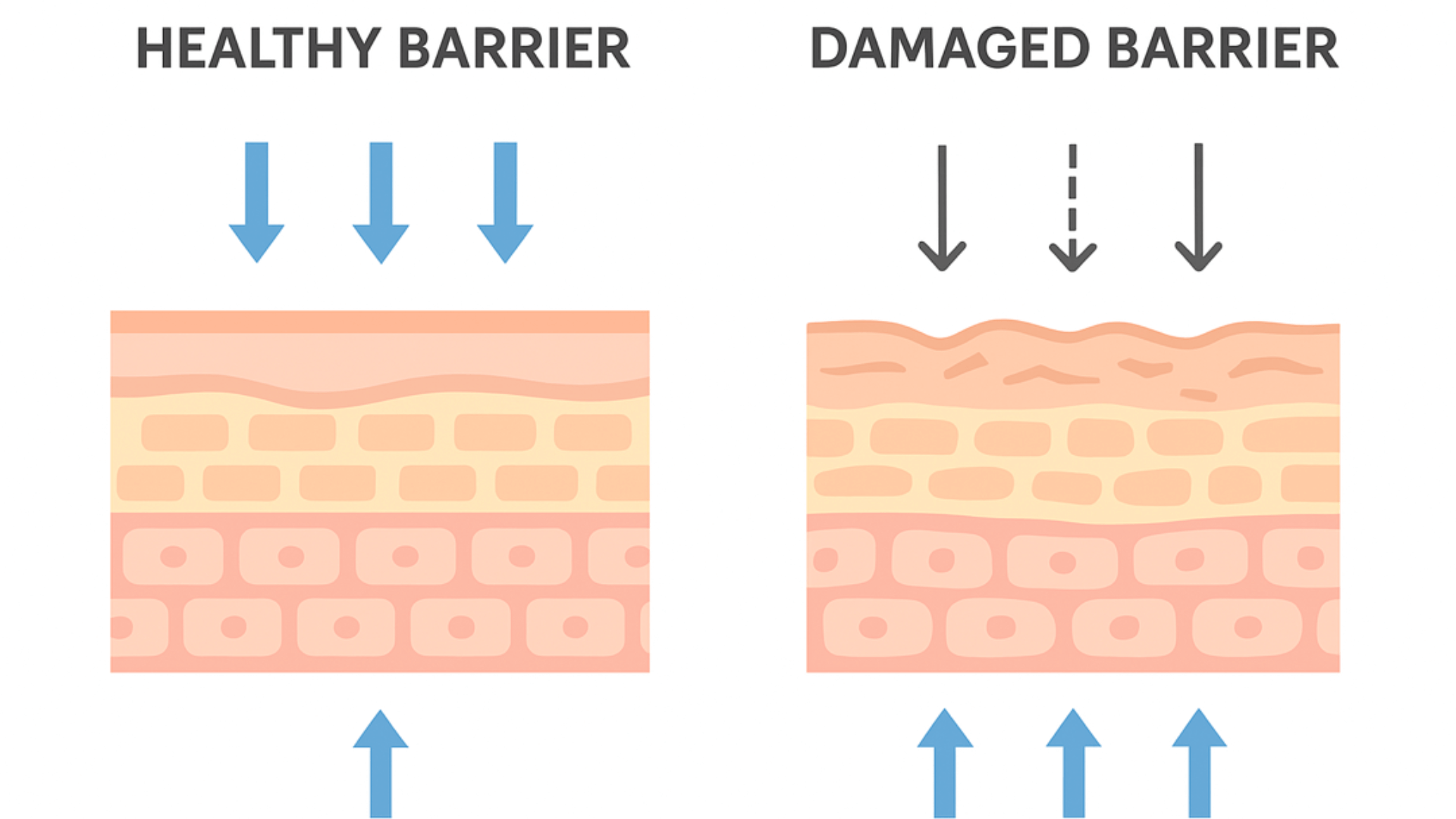 Geschädigte Hautbarriere? So erkennst du sie und bringst sie mit Naturkosmetik wieder ins Gleichgewicht
