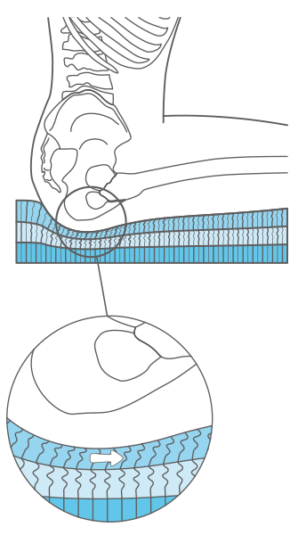 TR-V Stimulite Contoured Sitzkissen Minderung der Scherkräfte